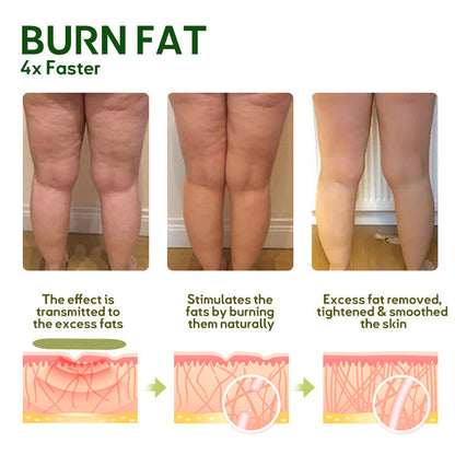 MugwortsLegs Cellulite Reduction Patches