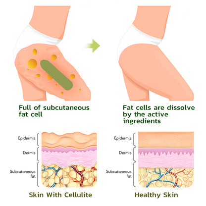 MugwortsLegs Cellulite Reduction Patches
