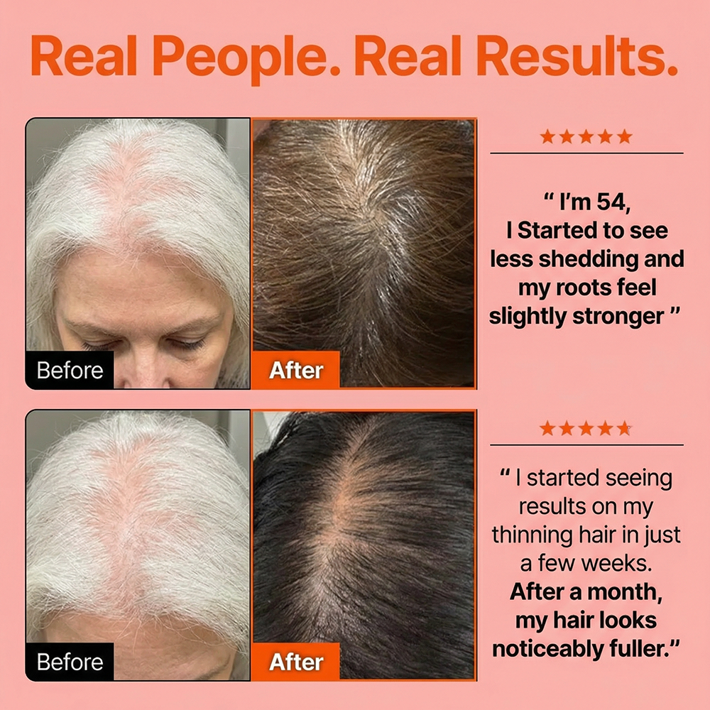 Hair Growth Serum with Massage Brush Applicator – Thickening & Hair Regrowth Scalp Treatment for Fuller, Stronger Hair