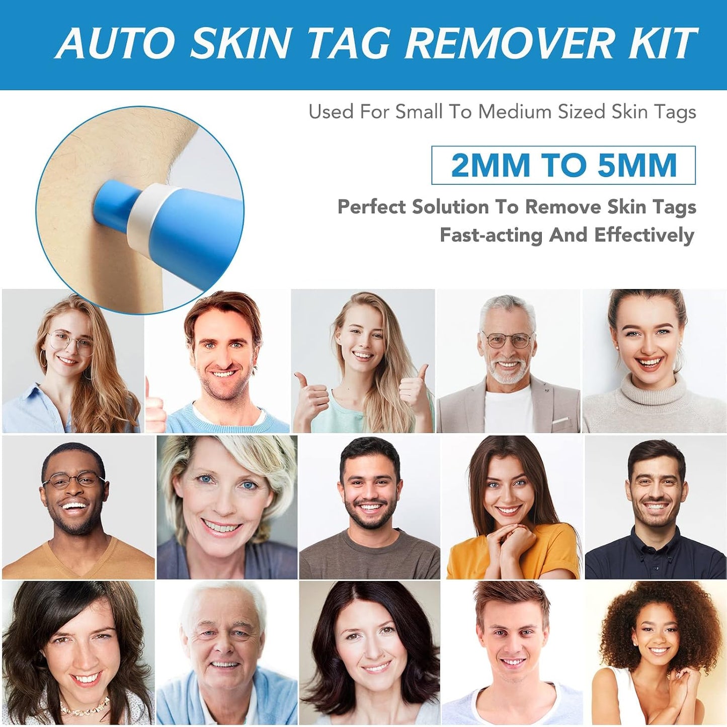 Painless Skin Tag Removal Kit