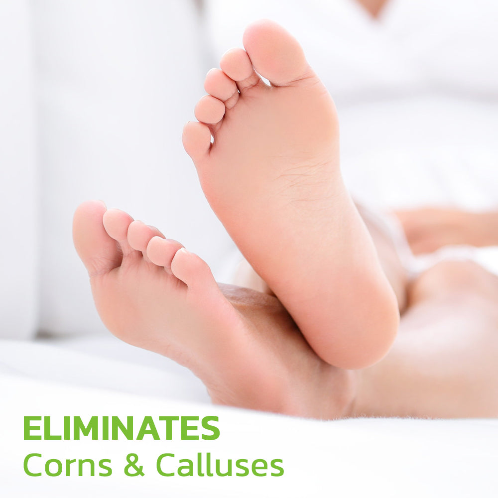 IHerbal Foot Callus And Corns Removal Soak