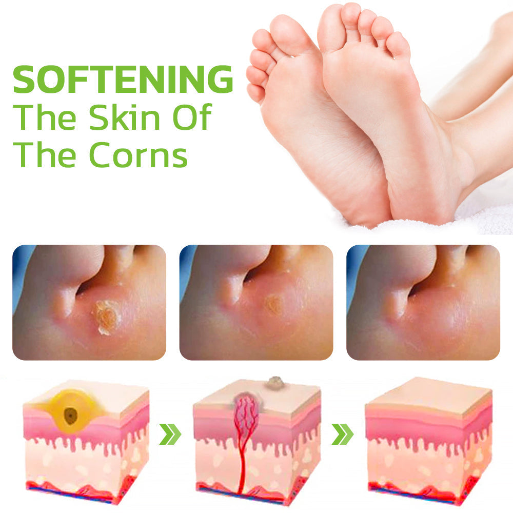 IHerbal Foot Callus And Corns Removal Soak
