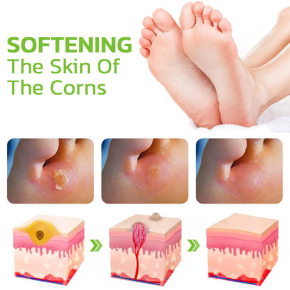 IHerbal Foot Callus And Corns Removal Soak